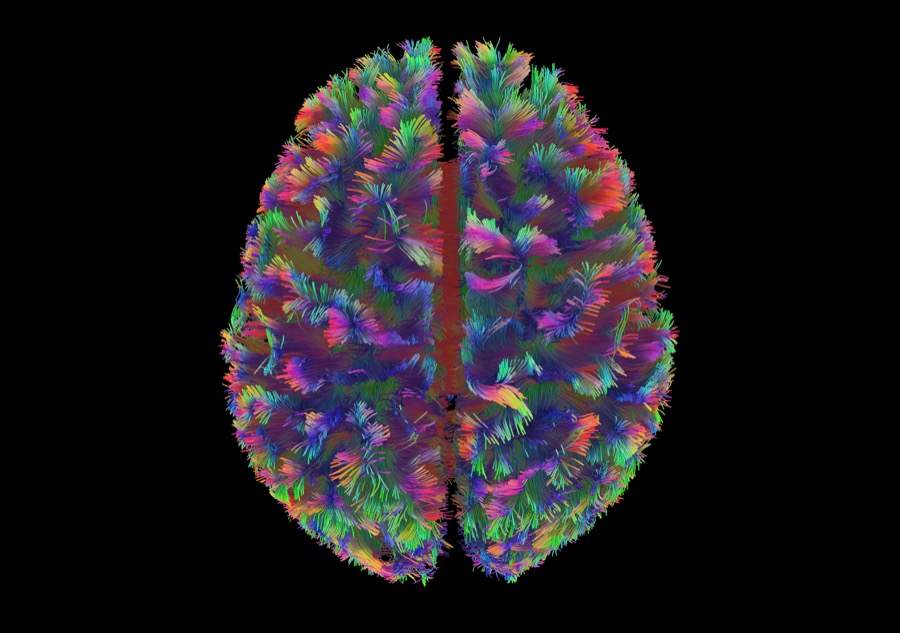 Whole-brain diffusion MRI render on a black background